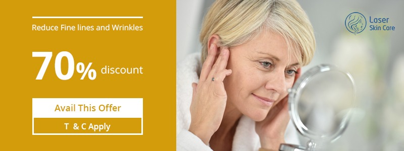 Reduce Fine Lines and Wrinkles with 70% Discount - Laser 